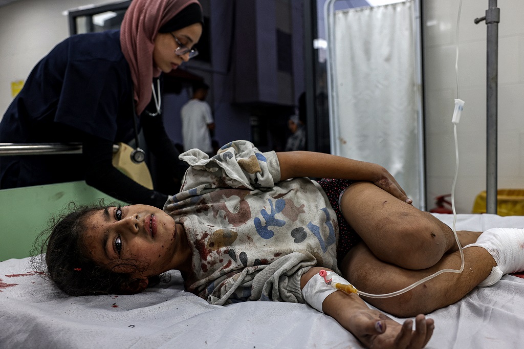 طفلة تتلقى العلاج في مستشفى الكويت التخصصي غرب رفح بعد إصابتها في القصف الإسرائيلي المتواصل على قطاع غزة (تصوير: أ ف ب)