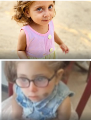 الطفلة سيلا قبل وبعد تدهور نظرها