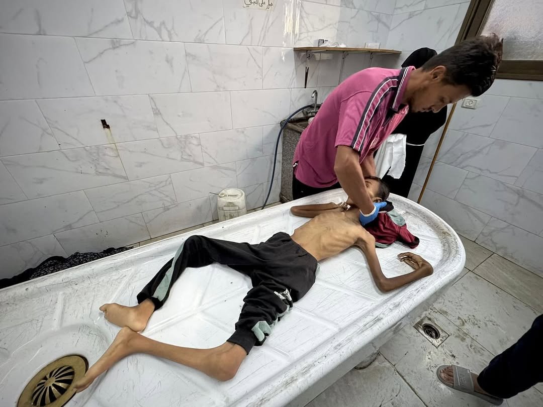 شهيد التجويع عبد الحميد الغلبان 