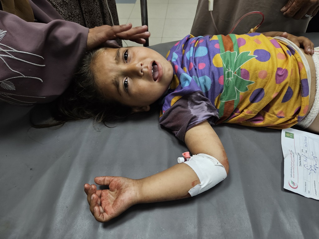 طفلة أصيبت في غارات الاحتلال تتلقى العلاج في مجمع ناصر الطبي في خان يونس جنوب قطاع غزة (الأناضول)