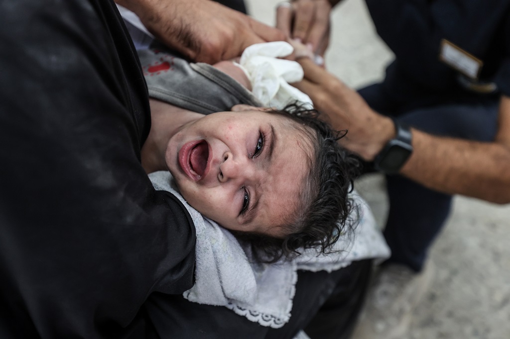 طفلة تتلقى العلاج في مستشفى الشفاء في غزة عقب إصابتها في غارات الاحتلال المتواصلة على القطاع (وفا)