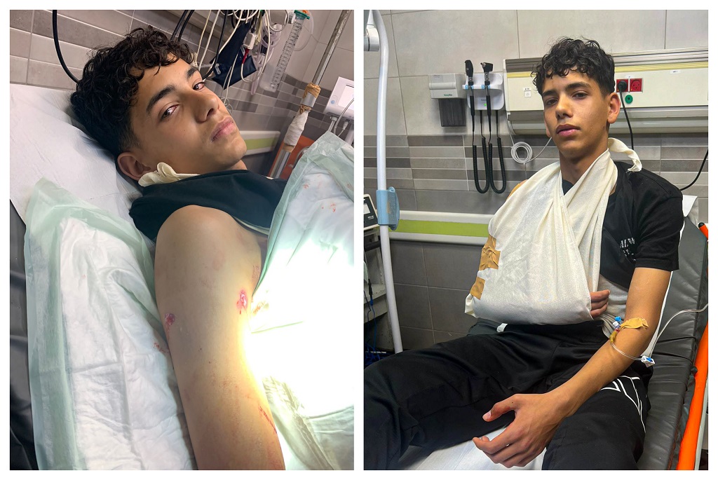 لاعب فريق هلال القدس تحت 17 عاما، خضر غراب، يتلقى العلاج في المستشفى عقب إصابته برصاص مستوطن في القدس المحتلة