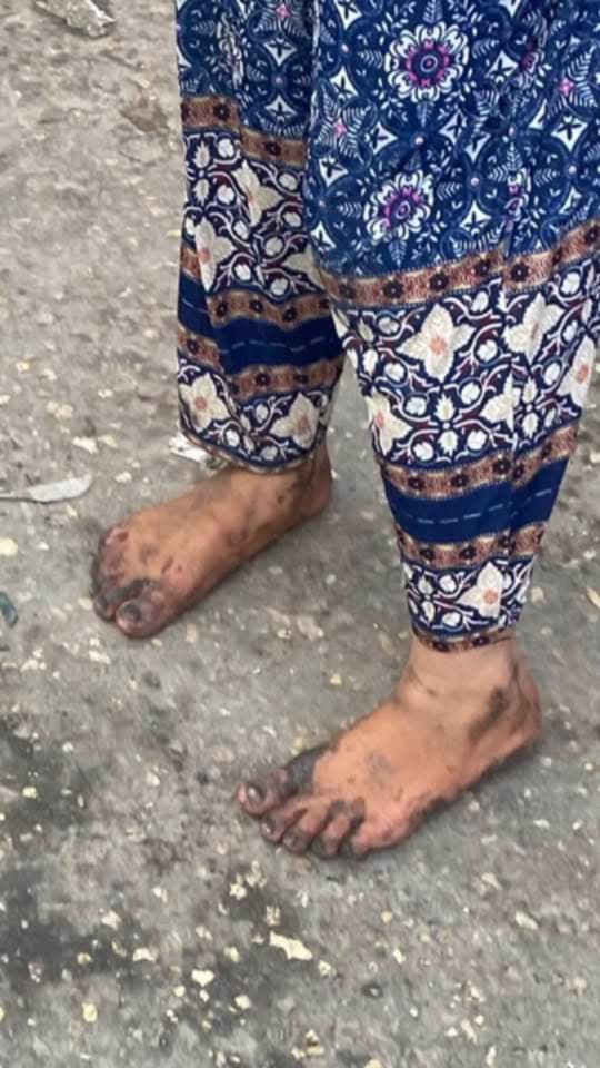 (تصوير: سامي أبو سالم/ وفا)