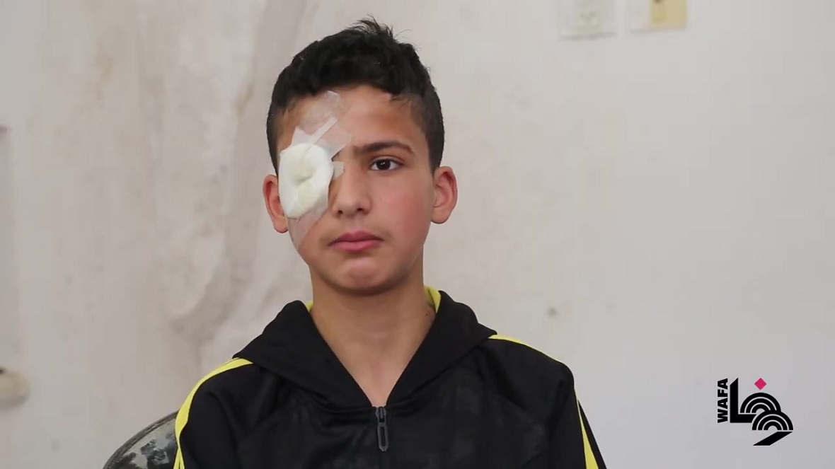 الطفل عز الدين البطش